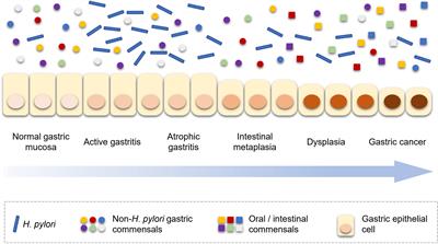 Gastric microbiota in gastric cancer: Different roles of Helicobacter pylori and other microbes